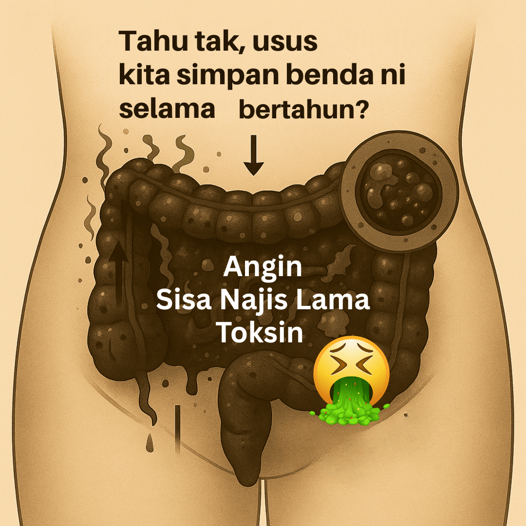 Usus tersumbat penuh angin, najis lama dan toksin